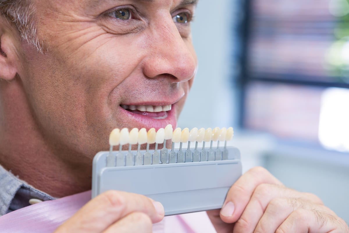 Veneers in O'Fallon